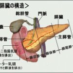 すい臓がん